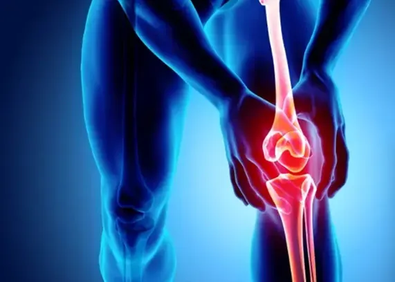 Kenali Gejala Awal Osteoarthritis yang Sering Diabaikan