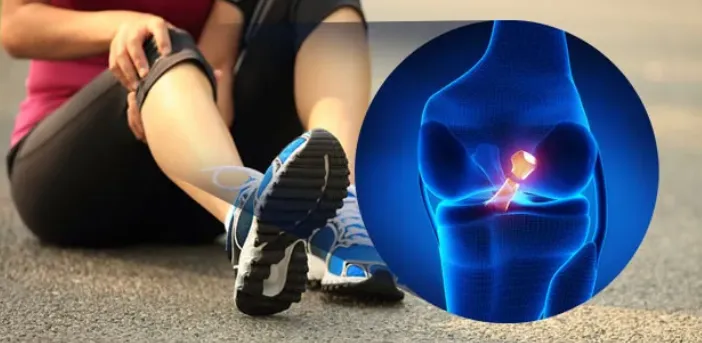 Perbedaan Cedera Ligamen dan Cedera Tulang