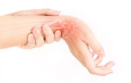 Tips Mengatasi Nyeri Tangan Akibat Carpal Tunnel Syndrome